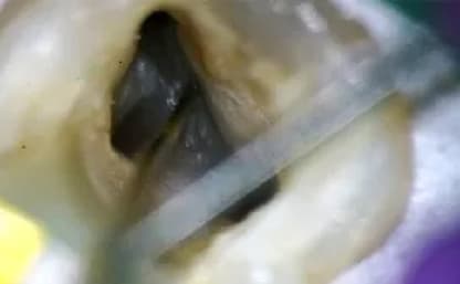 マイクロスコープの写真