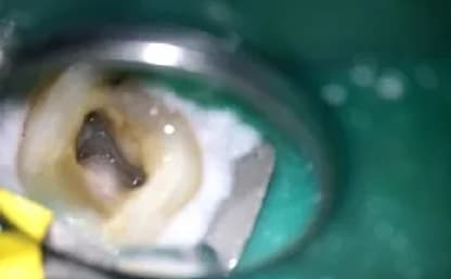 マイクロスコープの写真